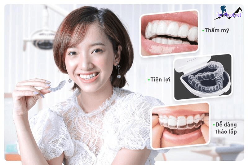 Top 3 địa chỉ niềng răng invisalign tại Ninh Bình uy tín nhất và trách nhiệm cực kì cao